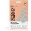 Face Facts Blemish Patches - Clouds (9958) (39941-150) FF.C/20